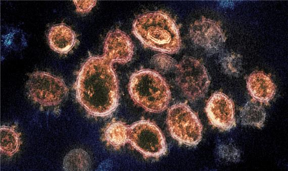 کشف روش از بین بردن ویروس کرونا طی 25 ثانیه
