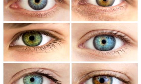 13 توصیه مهم برای محافظت از چشم در برابر خطر‌ها