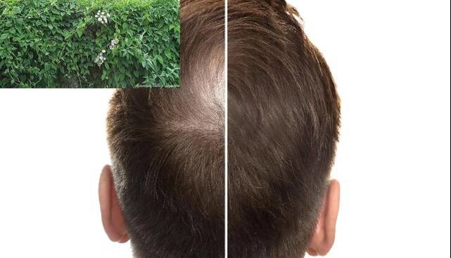 این گیاه می‌تواند کلید رشد مجدد مو باشد